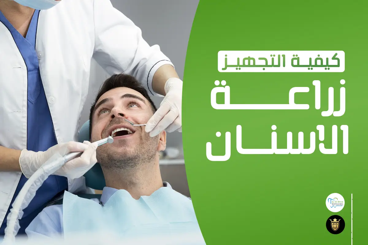 كيفية الاستعداد لزراعة الأسنان ؟