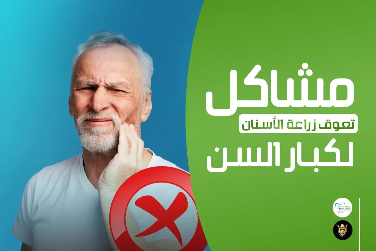 مشاكل زراعة الاسنان لكبار السن